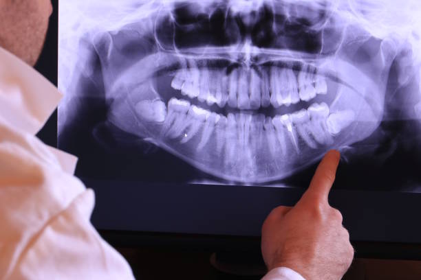 Best Emergency Dental Surgery in Myrtle Creek, OR